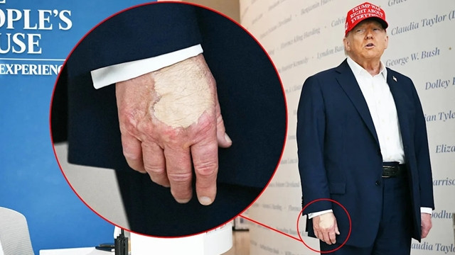 Is Trump Dead? A Storm of Discussion on Social Media