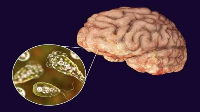 8-Year-Old Dies After Suspected ‘Brain-Eating’ Amoeba Infection in Louisiana